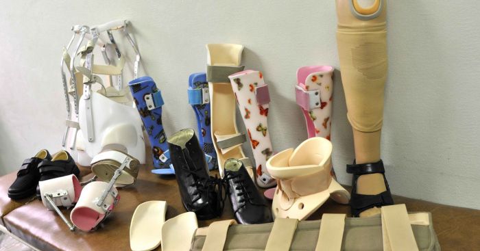 Decreto autoriza uso do FGTS para compra de próteses e órteses
