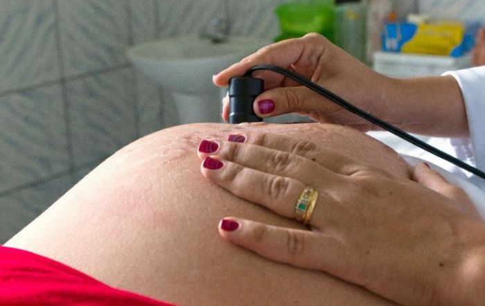 Em Aracaju, 17 de Março é o bairro com maior índice de gravidez na adolescência
