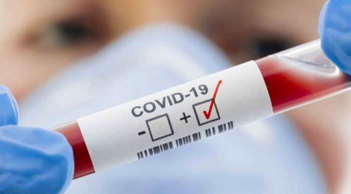 Alerta: Sergipe registra 561 casos de Covid-19 nesta quinta-feira, 26