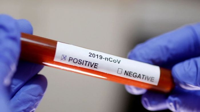 Sergipe já registra mais de 100 mil infectados pela covid-19