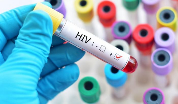 Câmara aprova projeto que exige sigilo sobre condição de pessoa com HIV