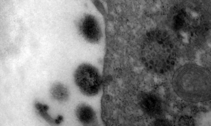 Covid-19: anticorpos podem durar até 12 meses após infecção Estudo foi publicado por pesquisadores chineses