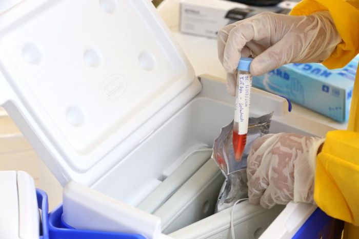 Aracaju confirma primeiro caso de flurona, infecção por coronavírus e influenza